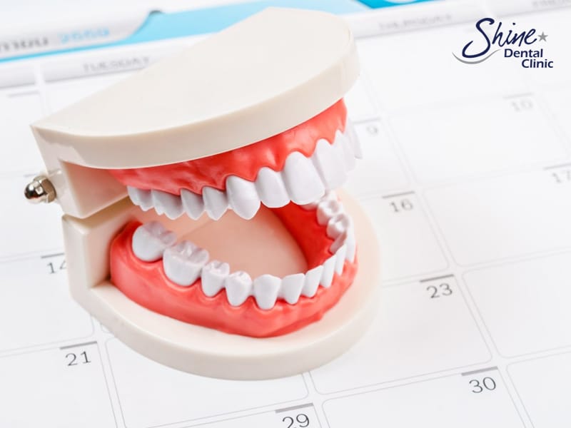 How Often Should I Visit the Dentist? Dentist Alton
