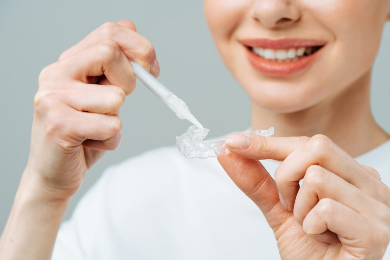 Teeth Whitening